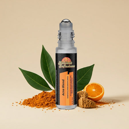 Acne Herbal Remedy Oil for Clear Skin by Ancient Infusions